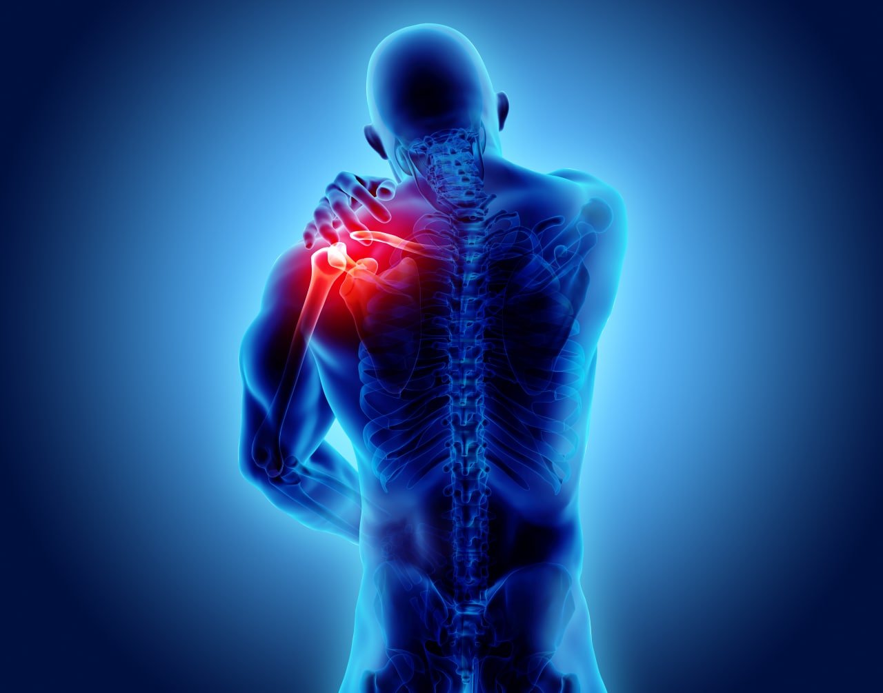 Shoulder/upper arm Ultrasound Scan