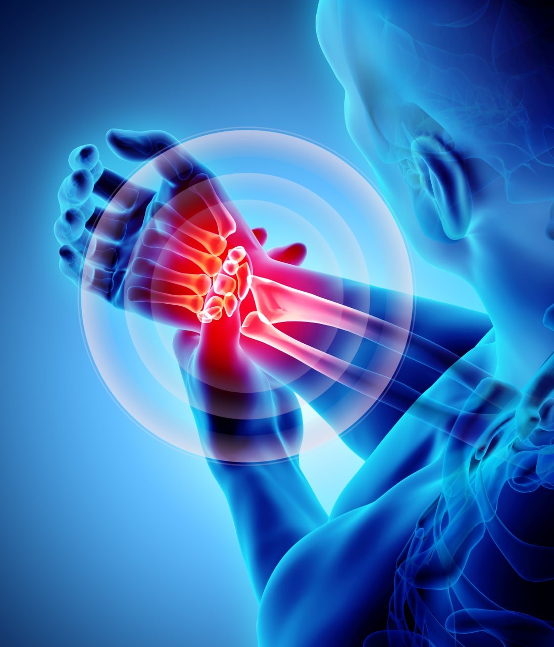 Wrist Ultrasound Scan