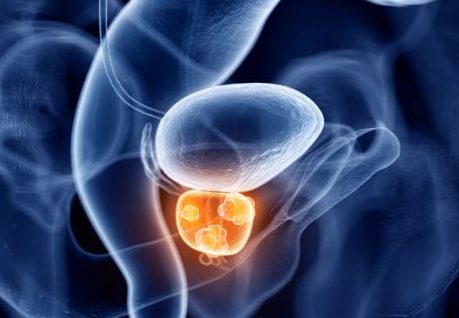 Prostate & Bladder Ultrasound Scan
