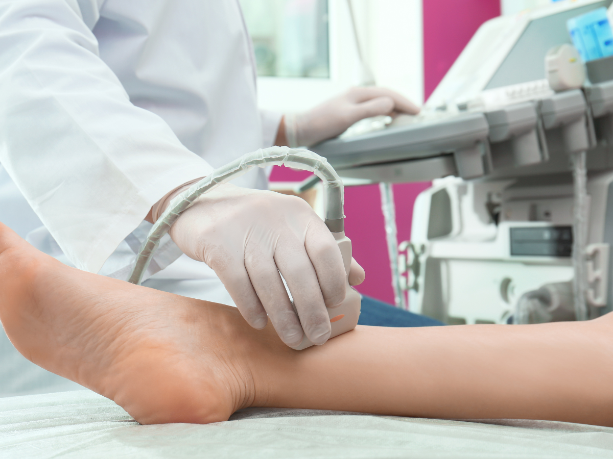 Arterial Doppler Ultrasound (Legs & Arms)