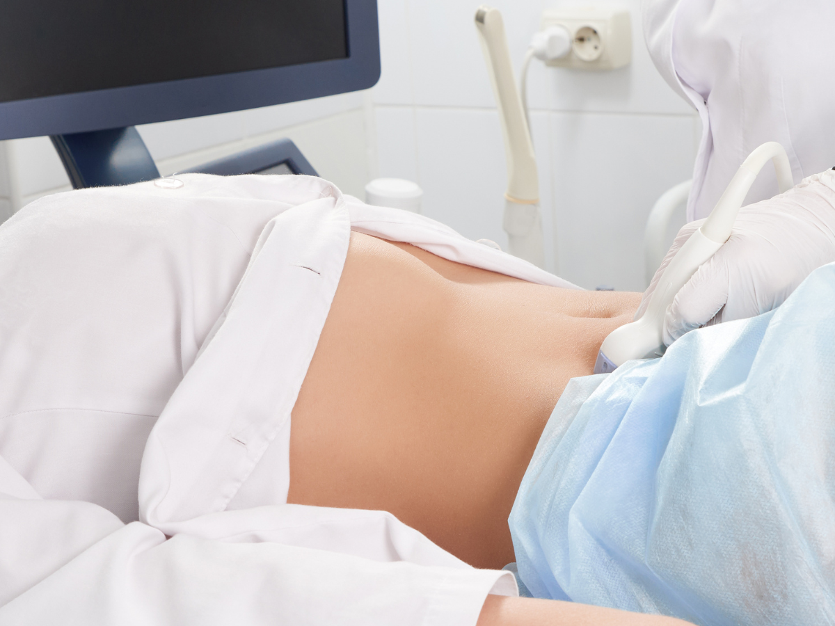 PCOS Ultrasound Scan