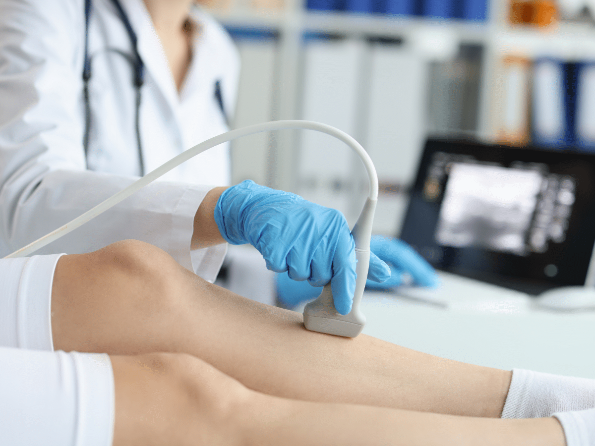 DVT / Venous Doppler Ultrasound Scan